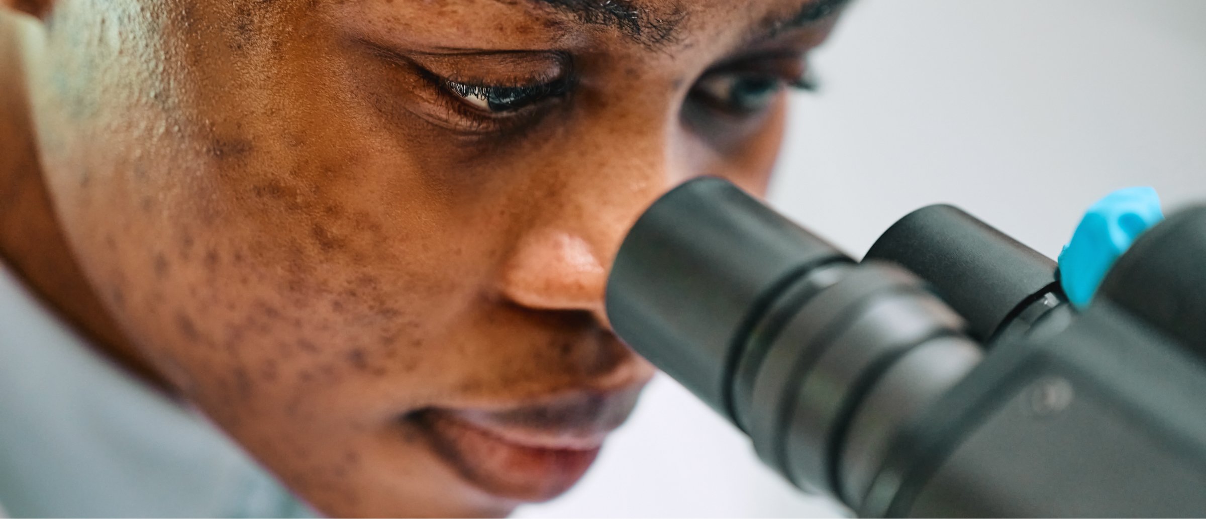  A close-up image of a person intently looking through the eyepiece of a microscope. The person, focused on their work, is examining something with great attention to detail. The microscope's black eyepiece is visible, along with a hint of blue equipment. The scene captures the precision and concentration required in scientific research or medical diagnostics. The lighting is soft, highlighting the person’s concentration and the importance of their work.
